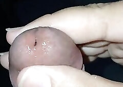 Trying to poison my penis with a ring.