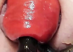Anyone in the mood for an fantastic close- up of an anal prolapse in various sizes