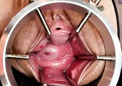 Phat Views Of My Wide Open Cunt And Cervix