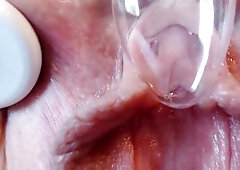 The gel is an electrode gel to concentrate the current