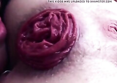 Anal prolapse, Lick arsehole, anal gape, gaping rectal hole